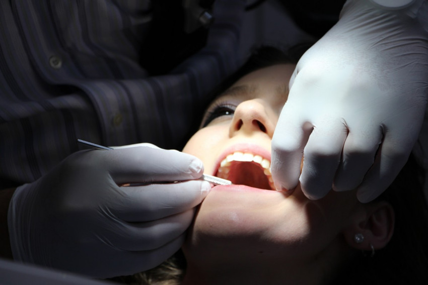Hire Expert Dental Services For Wisdom Teeth Removal