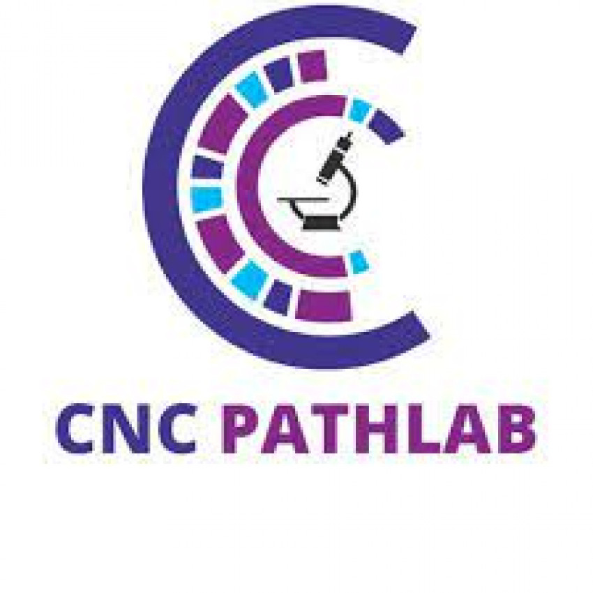 CNC Pathology lab in Delhi, Jhandewalan