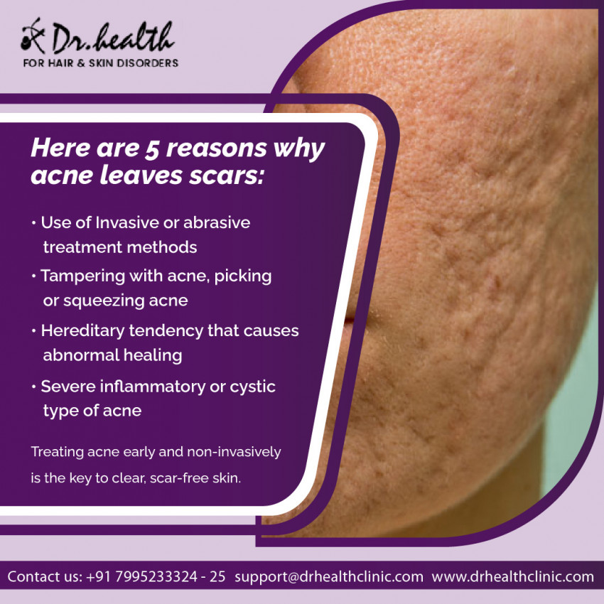 Are you tired of your skin problems? Consult with the Best Dermatologists in Bangalore
