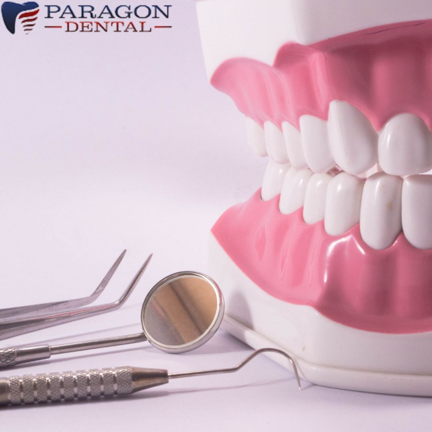 Why Emergency Dental Services are Essential for Your Oral Health