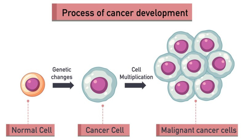What are the different stages of cancer and their corresponding treatments