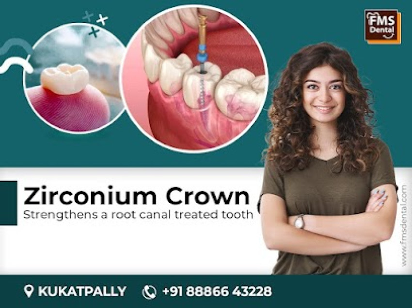 Importance of Zirconium Crown - FMS Dental Hospital