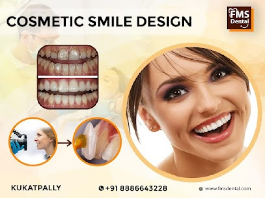 Crafting Radiant Smiles: The Essence of Cosmetic Smile Design by FMS Dental Hospital