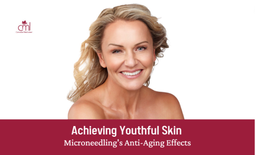 Achieving Youthful Skin: Microneedling's Anti-Aging Effects