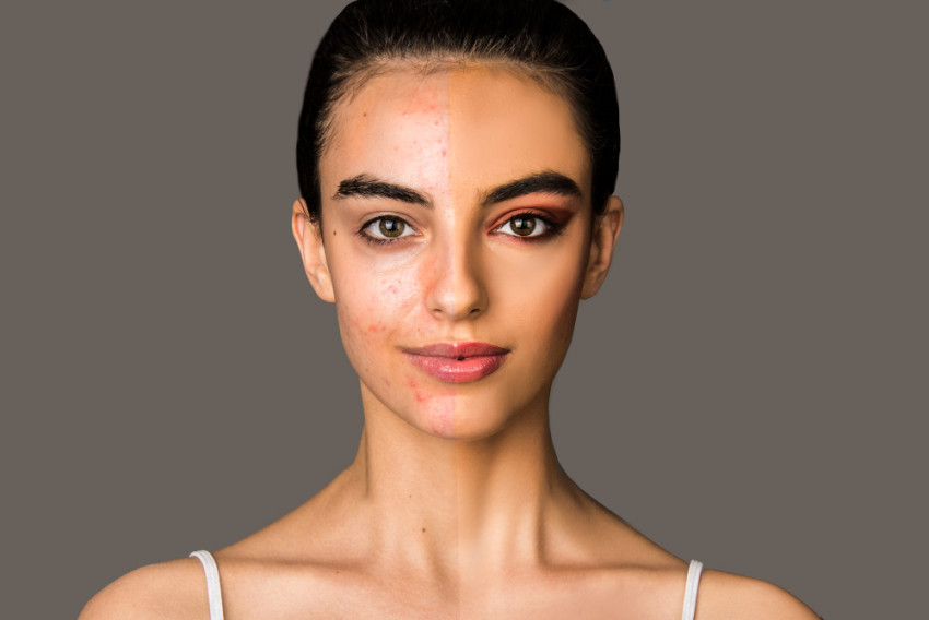 Faces Aesthetics: Unveiling Timeless Beauty with Faces on Faces