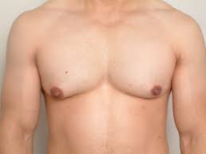Zeinth Plasticare: Your Path to Confident Living with Gynecomastia Surgery in Delhi