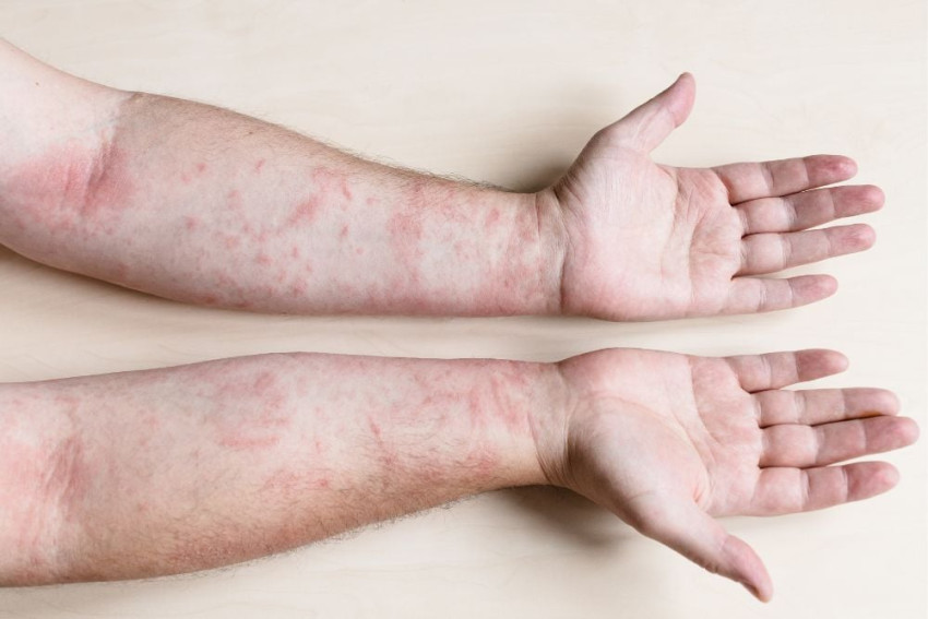 Integrative Medicine Approaches to Skin Disease Treatment in Dubai