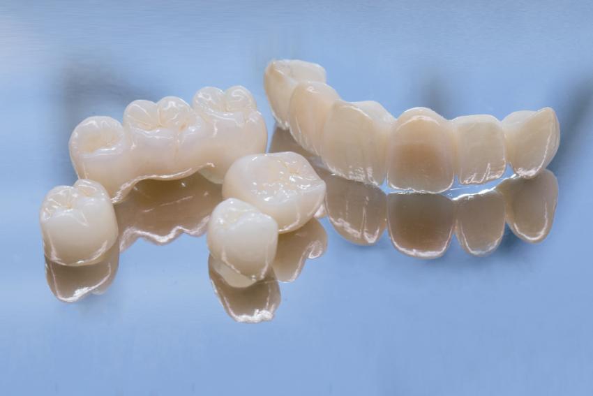 Why Dental Crowns are Matter And When They’re Necessary
