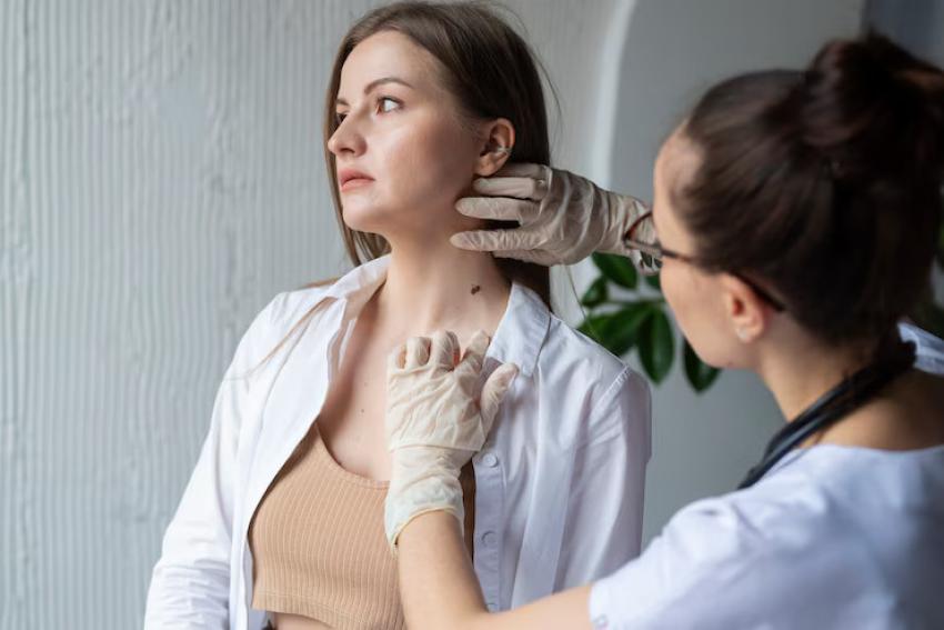 What is the survival rate for non-melanoma skin cancer?