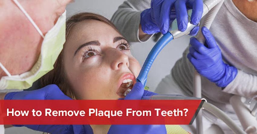 How to Remove Plaque from Teeth?