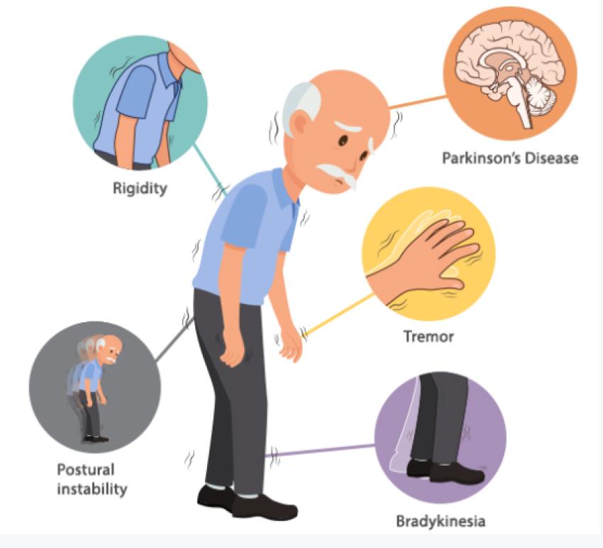 Best Exercises for Parkinson’s Patients: Improve Balance and Mobility
