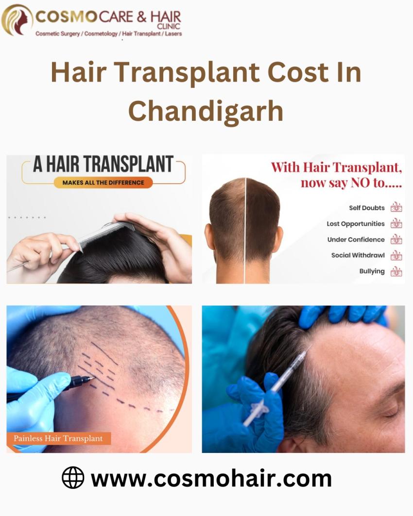 Why Quality Beats Cheap Hair Transplant Cost in Chandigarh