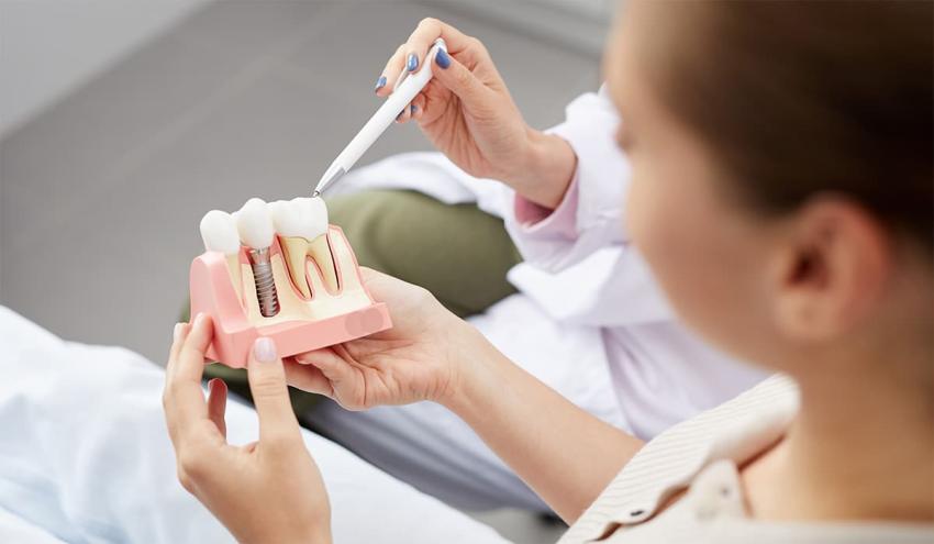 Why Choose Camas Periodontics for Dental Implants ?
