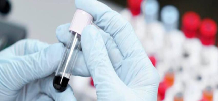 CBC Test Price Kolkata: Affordable Blood Work Near You