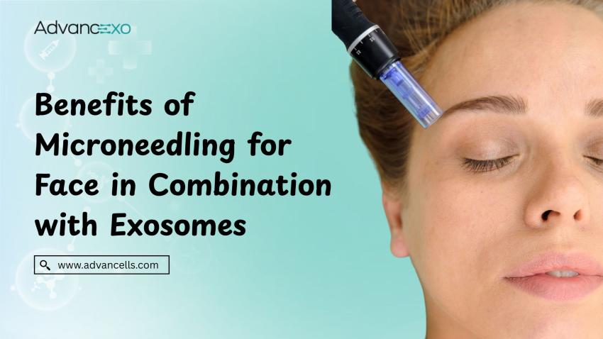 Benefits of Microneedling for Face in Combination with Exosomes