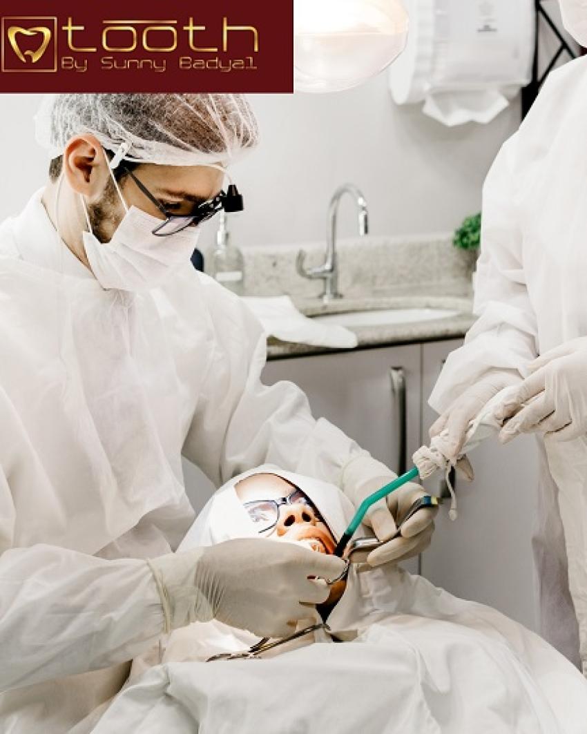 Transform Your Smile with Advanced All on 4 Dental Implants Sacramento