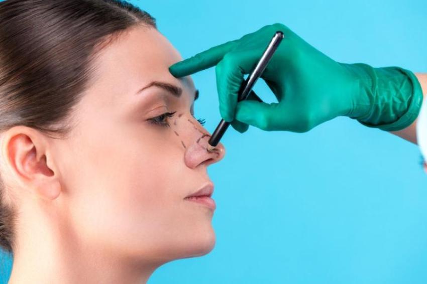 What Should You Really Expect One Week After Rhinoplasty?