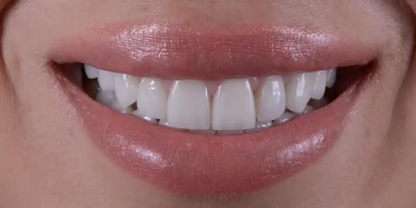 What to Expect During Your Child’s First Dental Visit