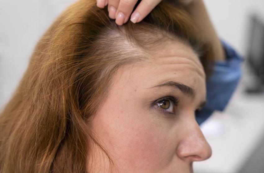 Effective Solutions for Thinning Hair: What You Should Know