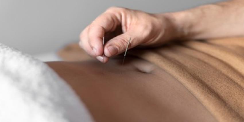 Acupuncture for Infertility: When to Start Treatment for Optimal Results