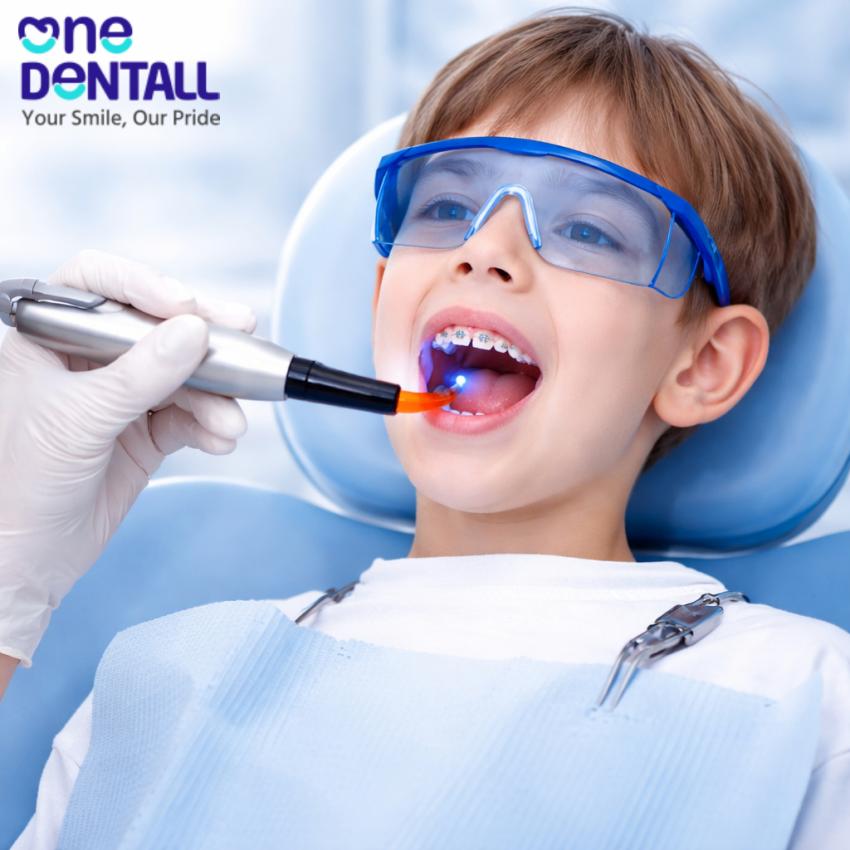 One Dentall in Belgaum Professional Laser Treatment for Pain-Free Cavities