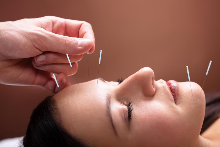 What to Expect During Sciatica Treatment with Acupuncture