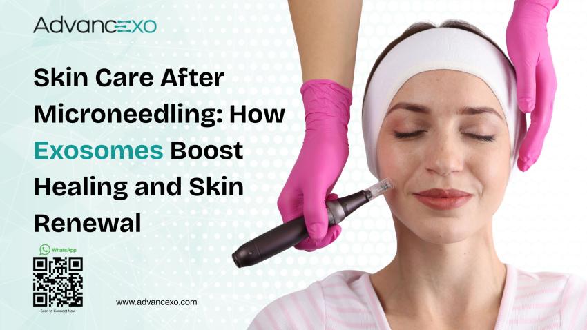 Skin Care After Microneedling: How Exosomes Boost Healing and Skin Renewal