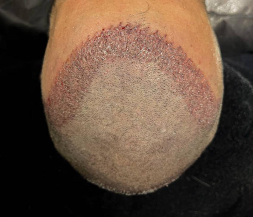How Chemical Hair Treatment Services Restore Smooth Hair Faster