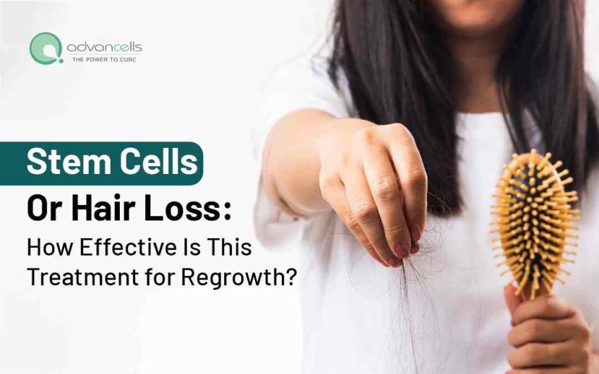 Stem Cells for Hair Loss: How Effective Is This Treatment for Regrowth?