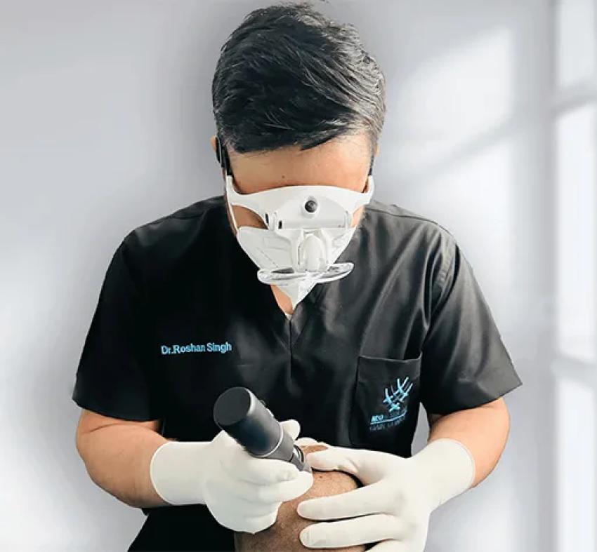 Crown Hair Loss? When Should You Consider a Hair Transplant?