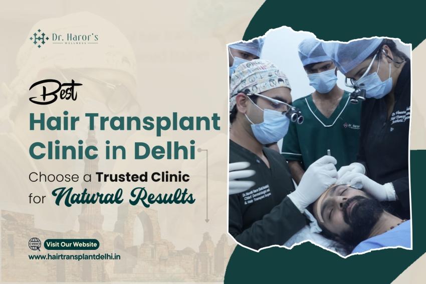 Best Hair Transplant Clinic in Delhi: Choose a Trusted Clinic for Natural Results