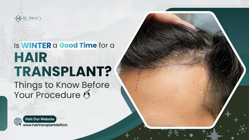 Is Winter a Good Time for a Hair Transplant? Things to Know Before Your Procedure