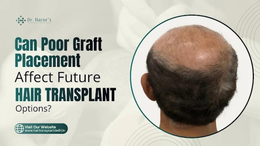 Can Poor Graft Placement Affect Future Hair Transplant Options?