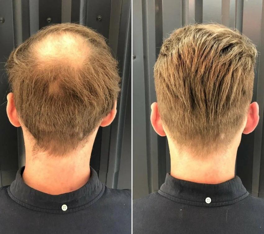 How to Care for Your Hair System: Washing, Styling and Touch-Ups